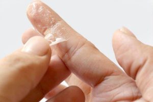 پاک-کردن-چسب-قطره-ای-از-روی-پوست