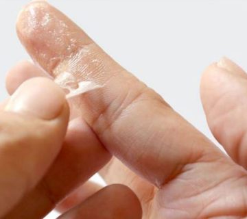 پاک-کردن-چسب-قطره-ای-از-روی-پوست